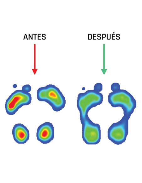 SMOU PLANTILLAS META DOLOR 45/46